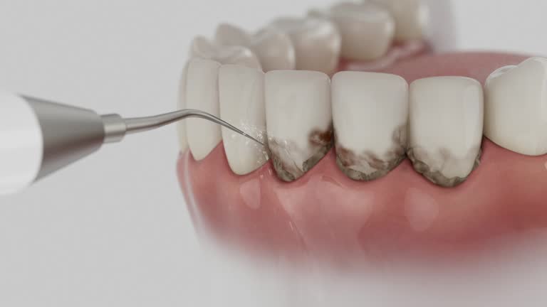 Reliable Dental Implants contractor in Columbus, MS by Smile Center Dentistry